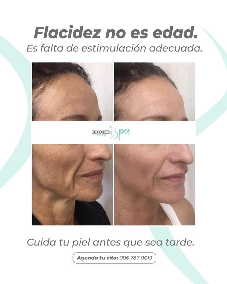 Tratamiento antiedad - BIOMED SPA STUDIO