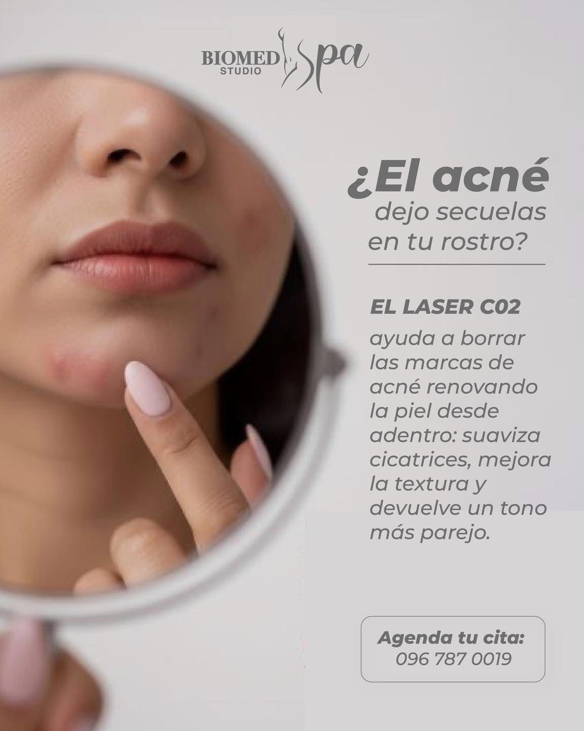 Láser CO2 acné - BIOMED SPA STUDIO